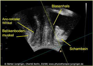 foto ultraschall 1